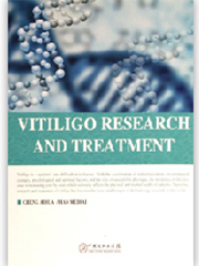 白癜风研究与治疗（英文版）